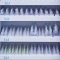 Caixa de armazenamento médico com divisor ajustável