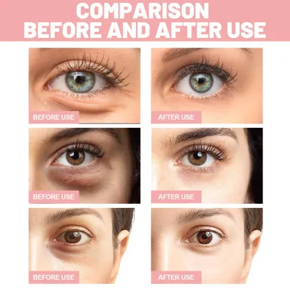 Ouhoe Pink Rose Eye Mask for Fine Lines, Dark Circles, and Firming Skin