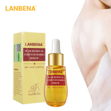 LANBENA Acne Scar Remove Serum Acne Treatment Remover Stretch Marks Anti Acne Shrink Pores Blackhead Whitening Cream Skin Care