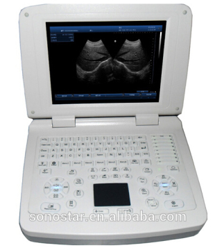 V10(SS-10V) Veterinary Laptop PC Based Ultrasound B Scanner(3D image optional)