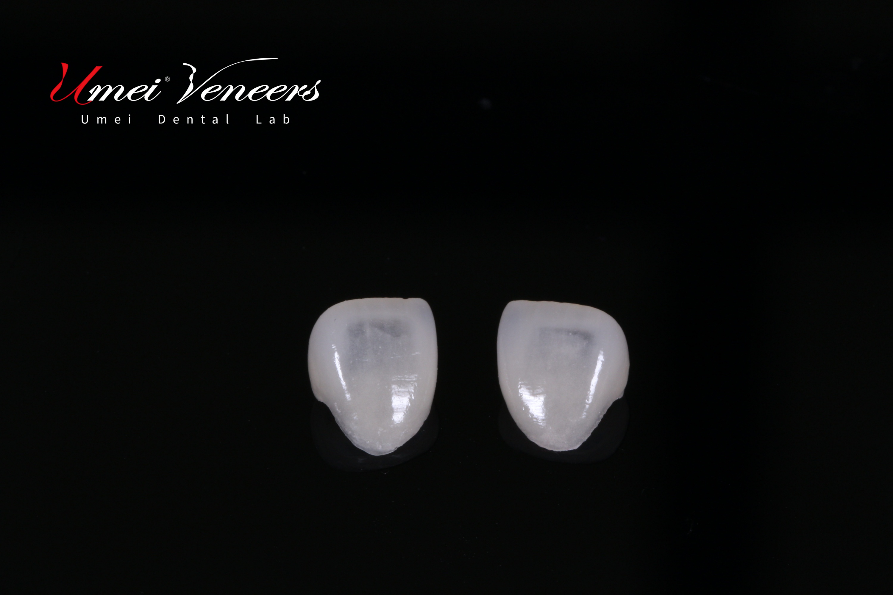 veneer