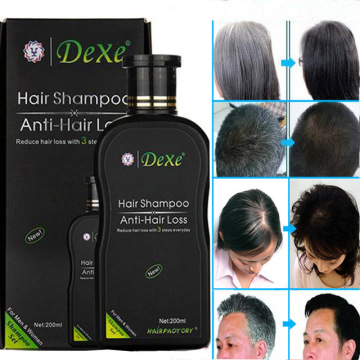 Dexe Hair Growh Shampoo for Hair Regrowth Anti Hair Loss Chinese Hair Growth Product Prevent Hair Treatment for Men Women 200ml