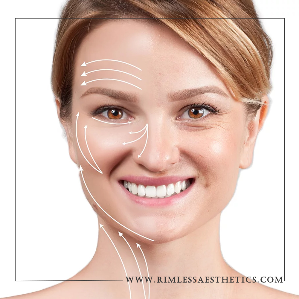 The Anti Aging Skin Care Products Dermal Fillers