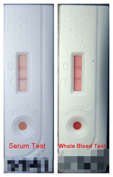 One-Step Foot and Mouth Disease (FMD)NSP Ab Test