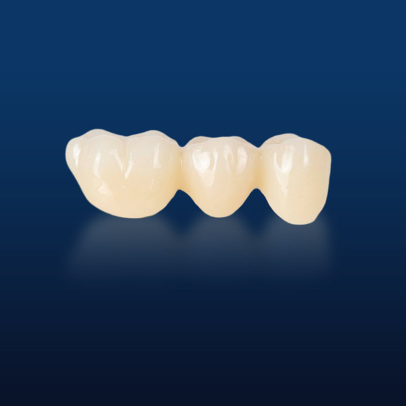 Full Zirconia crown,Full contour zirconia,Solid Zirconia,Zirconia,Monolithic Zirconia