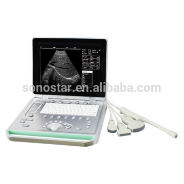 SS-7 Modle Portable Laptop Ultrasound Scanner Machine
