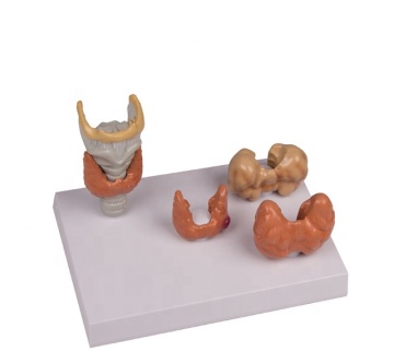 Diseased Thyroid Anatomical Structure Model