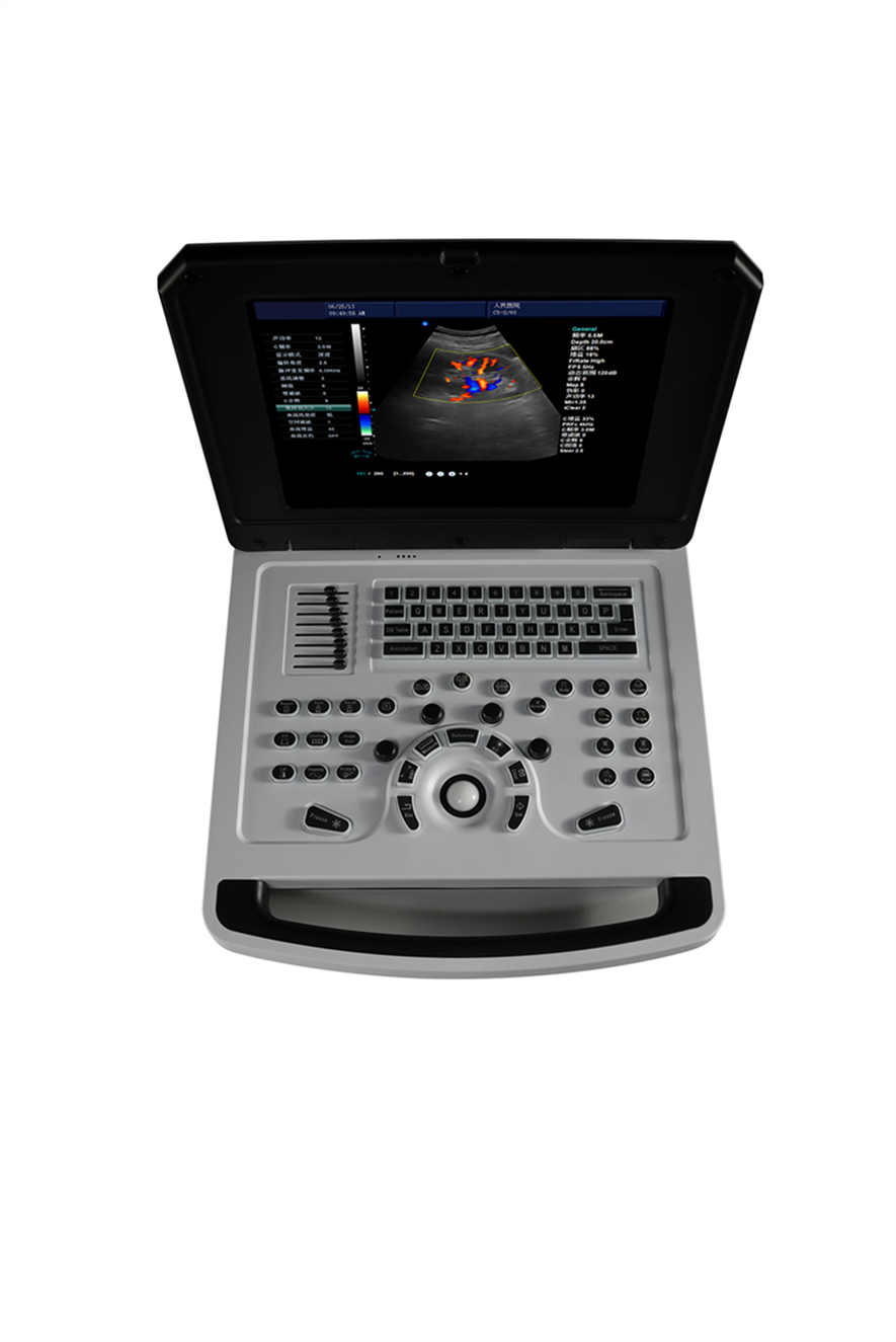 Sistema de diagnóstico ultrassônico de cor doppler em cores digitais completas