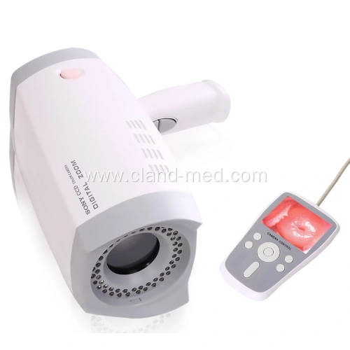 Perinav Camera Handheld Digital Full hd Camera for Vagina Colposcope China ...