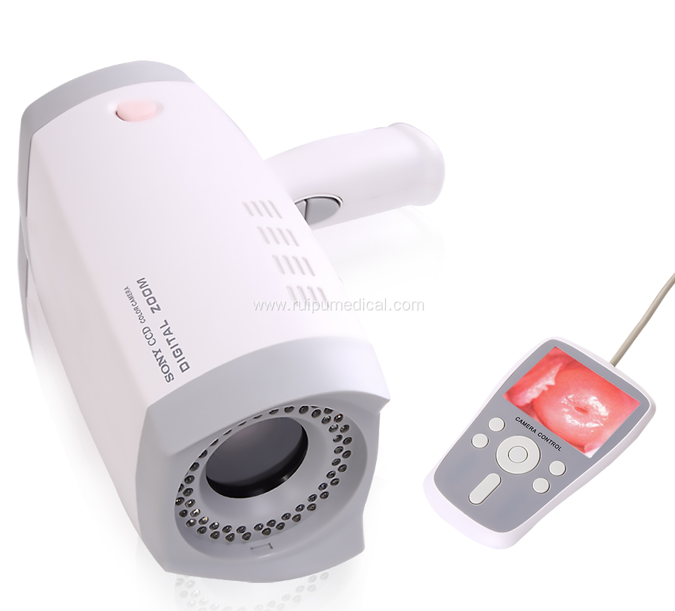 Handheld Digital Full hd Camera for Vagina Colposcope