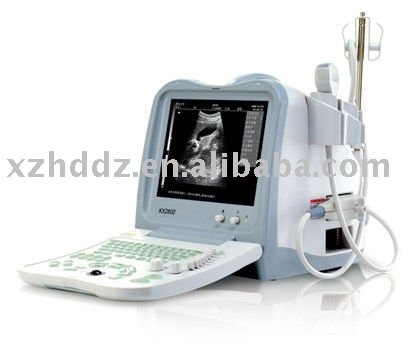B mode ultrasound scanner(portable)