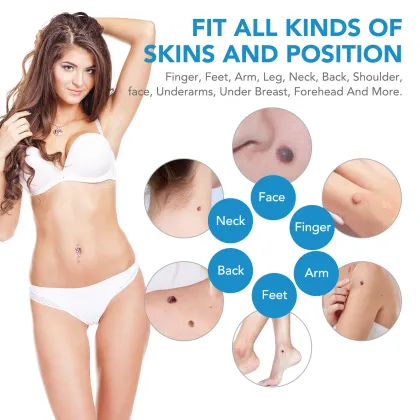 Best 2-in-1 Acne Pimple Blemish Treatment & Skin Tag Removal Machine