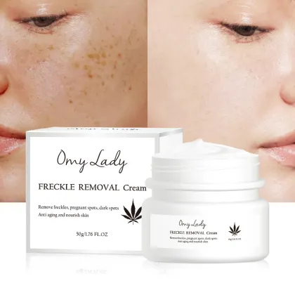 Omylady Organic Face Moisturizer - Freckle Fade Removal Cream