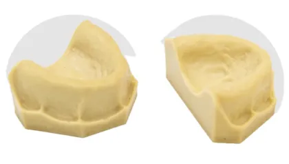 Dental Study Model Clinic Demonstration: Implant Model with Restoration and Implant Bridge