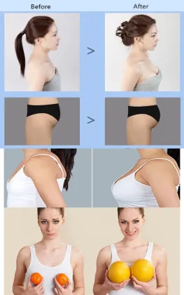 Hyaluronic acid breast injection breast enlargement