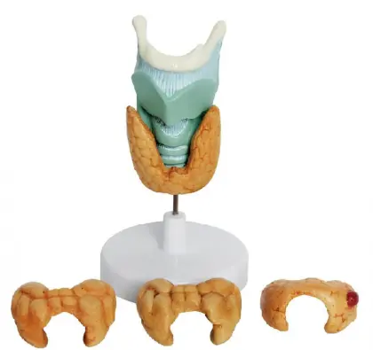 Thyroid pathological model