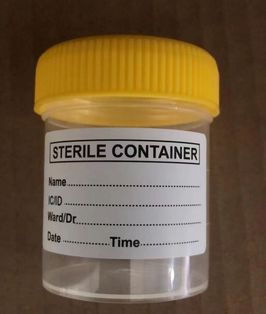 Hôpital 60 ml tasse de conteneur d'échantillons d'urine