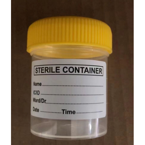 Hôpital 60 ml tasse de conteneur d'échantillons d'urine