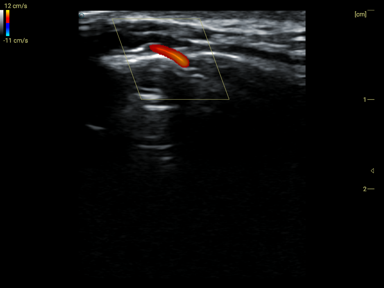 High-Frequency Handheld Ultrasound Probe – Pe
