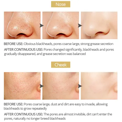 Bamboo Charcoal Blackhead Remover Nose Mask