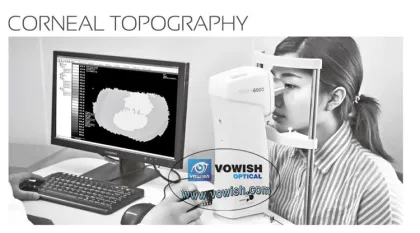 High-Quality SW-6000 Corneal Topographer Search