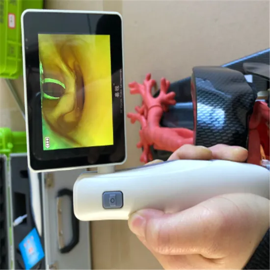 Anesthesia Video Laryngoscope Series