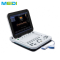 Cutting-Edge Doppler Ultrasound Machine for Diagnostic Applications