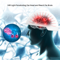 Transcranial 810nm NIR stimulation สำหรับการป้องกันระบบประสาทในสมอง
