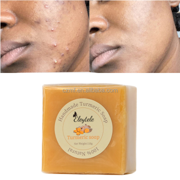 Natural Herbal Vegan Organic Anti-Acne Dark Spots Remover Soap