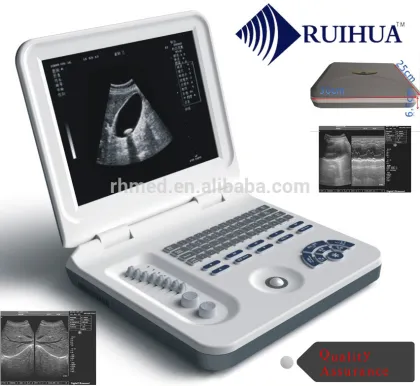 Pet B/W Laptop Digital Ultrasound Veterinary B/W for Puppy,Kitten,piggy