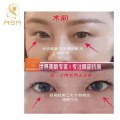 Sterile Ampoule Gene Peptide Allsensa Dark Circle Solution Eye Bag Wrinkle Removal