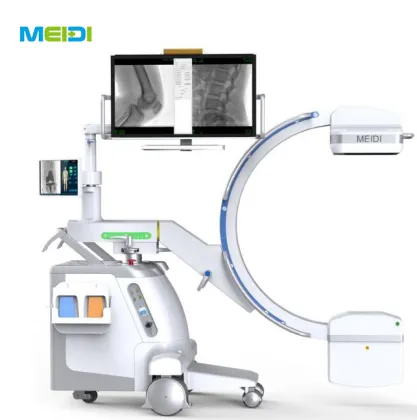 Mobile Integrated Flat Panel C-Arm Machine