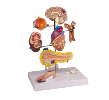 Human Hypertension Measurement Models and Instruments
