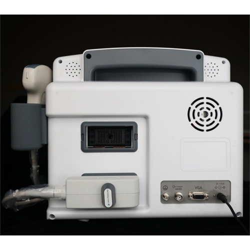 Human Ultrasound Scanner Hot Sale MDK-660A Portable B-Ultrasound Machine Supplier