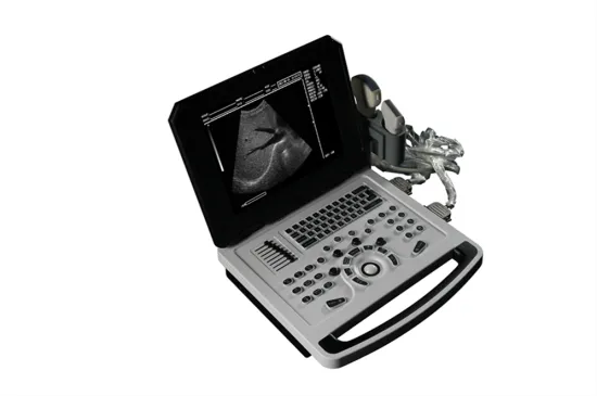 Laptop B Ultrasound Diagnostic Machine