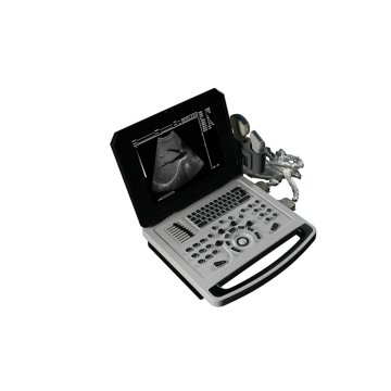 Máquina de diagnóstico de ultrasonido de la computadora portátil B