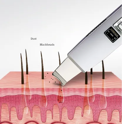 Beauty Care Rechargeable Ultrasonic Ionic Skin Scrubber