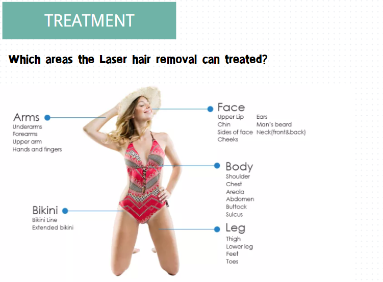 ipl hair removal safe effect