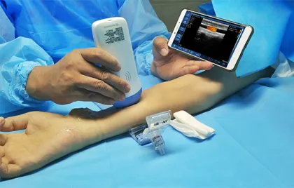 Wireless Ultrasound Wireless Ultrasound High Intensity