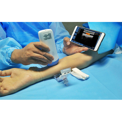 Portable Ultrasound Scanner for Anesthesia