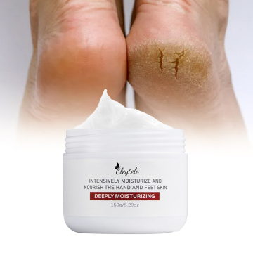 Custom Logo Salicylic Acid Foot Cream - 40% Urea Cracked Heel Repair