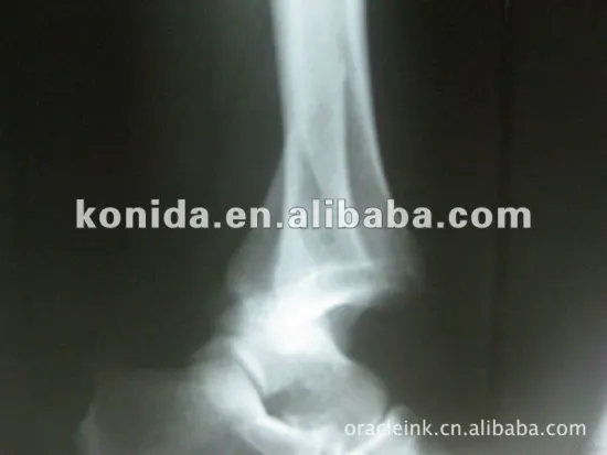 alibaba film alibaba express healthfilm