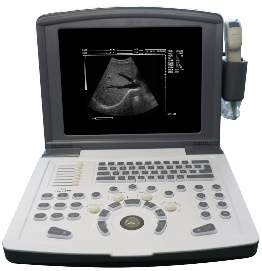 Tragbarer Schwarz -Weiß -Ultraschall -Scannermaschine in Medizin