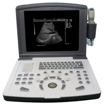 Portable Black &white Ultrasound scanner machine in medical