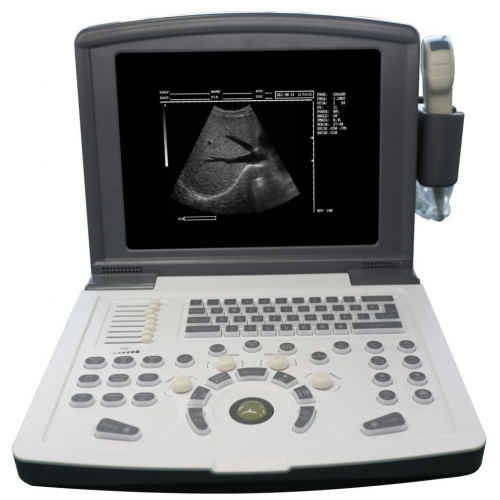 Laptop Ultrasound Machine Portable Black &white Ultrasound scanner machine in medical Factory