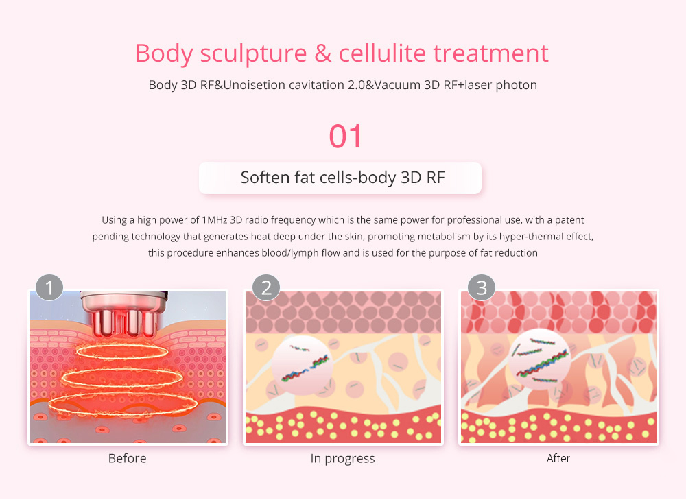 New Arrival 40K Cavitation 80K Vacuum RF Laser Pads Lipo Slimming fat burning 9 in 1 cavitation machine