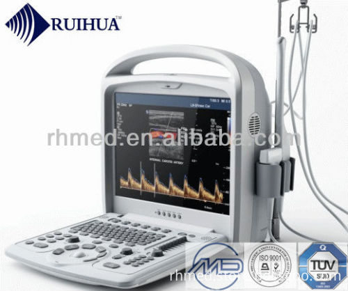 Colour Scan Instrument Portable 3d Color Doppler Musculoskeletal Ultrasound Scan Machine ...