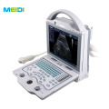 Portable 3D/4D Color Doppler Ultrasound Machine Digital Ultrasonic Diagnosis System for Human Use Medical Ultrasound Instruments