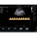KPC-3C Convex Palm Doppler ультрагукавая сістэма