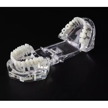 Dental Removable Demonstration for Teaching Teeth Model
